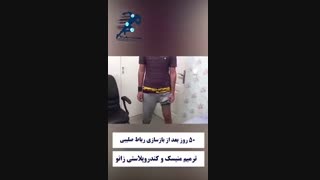 معاینه بیمار 50 روز بعد از جراحی رباط صلیبی