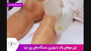 لیزر موهای زائد | فیلم لیزر موهای زائد | کلینیک پوست و مو نیل | شماره 16