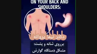 پرکاری غدد فوق کلیوی