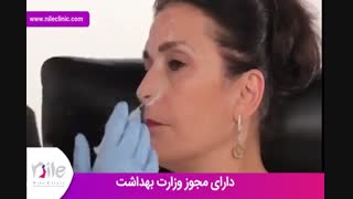 تزریق بوتاکس | فیلم تزریق بوتاکس | کلینیک پوست و مو نیل | شماره 22