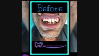 نمونه کار زیبایی دکتر سعید میرزایی