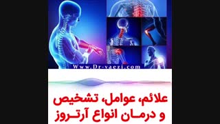 درمان آرتروز مفاصل بدون جراحی