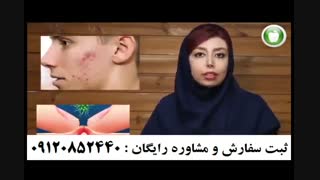 نظرات مشتریان راجب پک ضد جوش 09026665040 روکش دندان