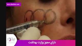 تزریق ژل | فیلم تزریق ژل | کلینیک پوست و مو نیل | شماره 27