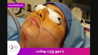 لیپوماتیک | فیلم لیپوماتیک | کلینیک پوست و مو نیل | شماره 27