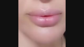 زیباترین تزریق ژل لب