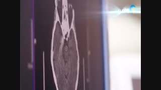 مراحل تحصیل در دانشگاه های خارج از کشور