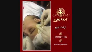 لیفت ابرو-جزیره زیبایی
