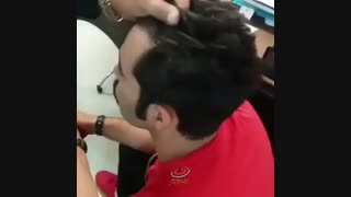 تجربه شخصی کاشت موی طبیعی