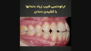 بهترین دکتر ارتودونسی تهران | دکتر داوودیان