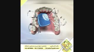 دستگاه دیستال جت | دکتر لادن طیبی