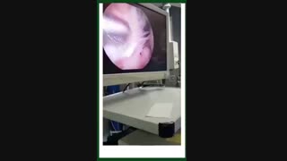 ترمیم منیسک و بازسازى رباط صلیبی