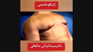 علت ایجاد ژنیکوماستی چیست ؟
