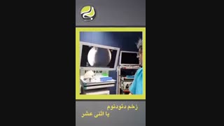 زخم دئودنوم یا اثنی عشر