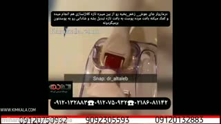 درمارولر های اصل کیم کالا | درمارولر تیتانیومی | درمارولر فولادی | از بین بردن چروک های صورت | 09120132883 روکش دندان