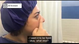 وقتی می خندم بینی پایین می آید