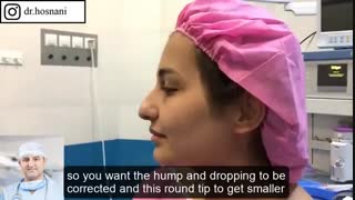 با یک بینی خوشگل و طبیعی به لندن برخواهد گشت