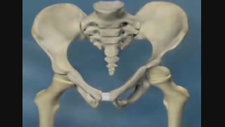 دیسپلازی مفصل ران در لگن