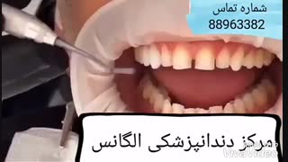 معروفترین دندانپزشک زیبایی درتهران | بهترین متخصص اندو در تهران | بهترین متخصص عصب کشی دندان در تهران