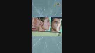 عمل جراحی بینی گوشتی و پهن با پیوند غضروف