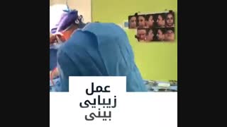 فیلم عمل زیبایی بینی توسط دکتر گیلدا گیوه چی