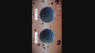 نقش ایمنی درمانی در سرطان چیست؟