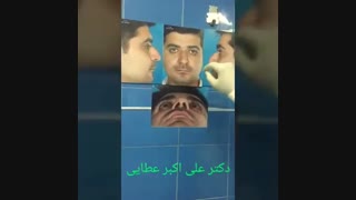 جراحی بینی مردانه