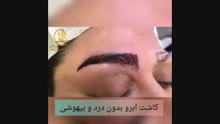 فیلم کاشت ابرو