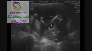 بهترین مرکز توانبخشی در البرز 09121623463|فردیس فلکه دوم ۱۷ شهریور فرعی یاس