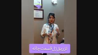 تزریق ژل قسمت چانه کلینیک لیزر