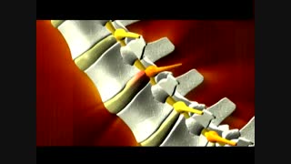 با ازن تراپی از دردهای کمر ، زانو ، مفصلی و ... رهایی یابید