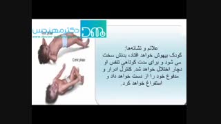 تشنج در کودکان