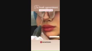 فرم دهی بینی با پلاسما جت