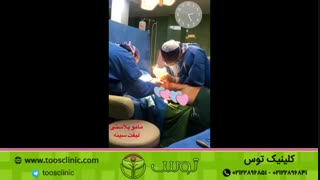 ماموپلاستی یا لیفت سینه