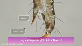 نمایی نزدیک از شپش سر