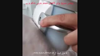 کرایولیپولیز و انجمادسلولهای چربی