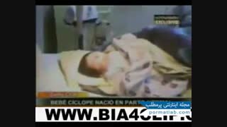 بچه ژاپنی یک چشم