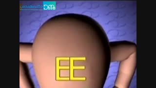 انحراف چشم
