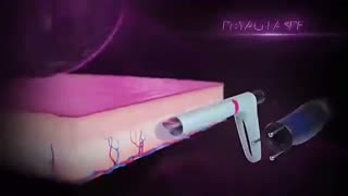 لیزر ژولیت
