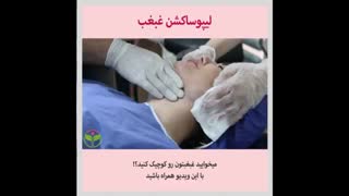 لیپوساکشن غبغب