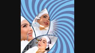 جشنواره تابستانه کاشت مو 98 کلینیک آریامن 02141608