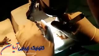 فیلم مراحل کاشت مو به روش ترکیبی FIT و FUT | کلینیک زیبایی آریامن