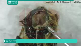 تشریح میکروسکپی بیماری زنبور عسل برای تشخیص بیماری