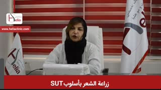 زراعة الشعر بطریقة sut | عیادة هلیا | 982122810089+