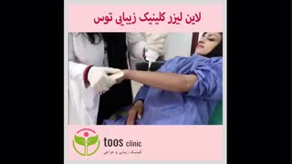 لاین لیزر کلینیک زیبایی توس